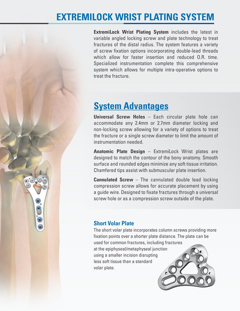 OsteoMed on Twitter "OsteoMed ExtremiLock Wrist Plating System