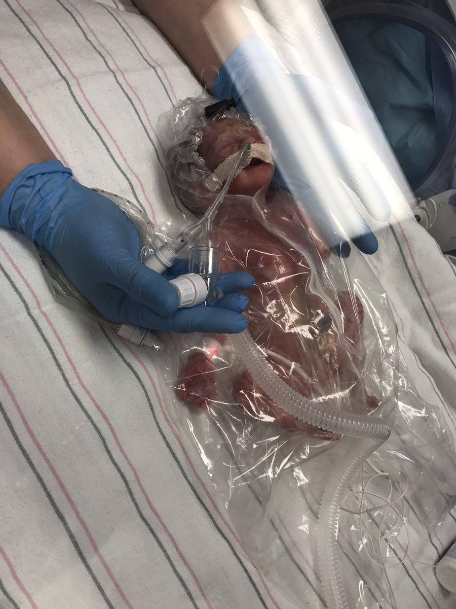 GamingByKayla's tweet photo. Camden is considered a micro preemie because he is under 2 lbs, 1 lb 8oz at birth.
#CamdensCause https://t.co/EcrKMPl93f https://t.co/Tt5Z8lO9Yw