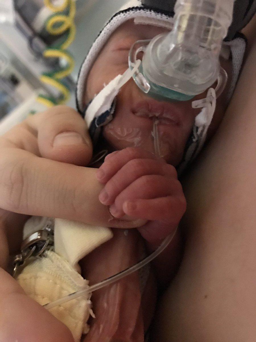 GamingByKayla's tweet photo. He may not truly know who I am yet, but he still held my finger, I am mommy after all #CamdensCause https://t.co/EcrKMPl93f @TheEllenShow https://t.co/BLrgk5QYXI