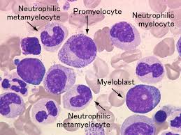 myelocyte and metamyelocyte