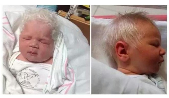 Baby Born With Silver Hair And His Parents Are Baffled Blah News India Tv
