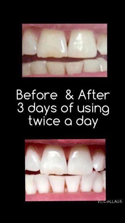 RCSCity's tweet image. This is a amazing review of one of my products! Who needs a #Dentist