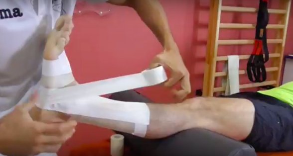 drddelgado's tweet photo. ¿Has sufrido un #esguince de tobillo? Mira cómo se debe realizar un vendaje funcional para este tipo de #lesión -> https://t.co/3xCplHtO1Z https://t.co/GxAHWwympd