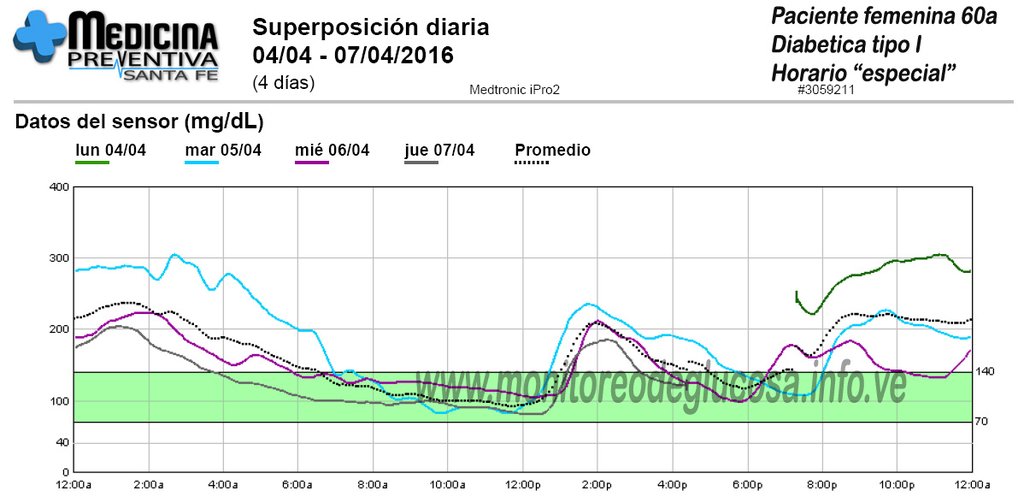 Monitoreo continuo de glucosa de paciente insulino dependiente con horario de actividad diaria y comidas alterado