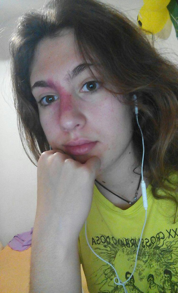 MariquillaMoon's tweet photo. Cada dรญa las ojeras se van marcando mรกs
#StopOjeras https://t.co/PRh9iivvFU