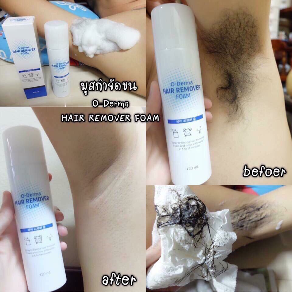cheripino1's tweet photo. ลองใช้มูสกำจัดขนรักแร้ เกลี้ยงสุดๆ ไม่ง้อมีดโกนละเด้อ ไม่เป็นตูดไก่ แร้ไม่ดำ ฉีดแล้วเช็ดจบค่ะชะนี นำเข้าจากเกาหลีด้วย กับหมออ้อยก็ทำได้ด้วย🙊 https://t.co/MrFjz4WExB