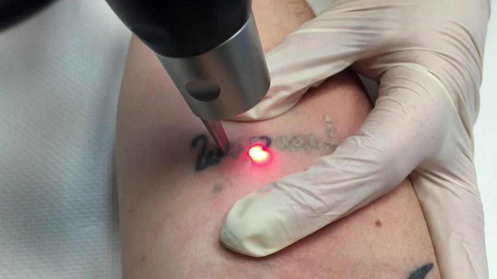 leninsmo11's tweet photo. The Rendon Center for Aesthetic Medicine located in Boca Raton is the best #tattoo #removal clinic in South Florida.https://t.co/WyvEnWS3lj https://t.co/wDm6b1qNtX