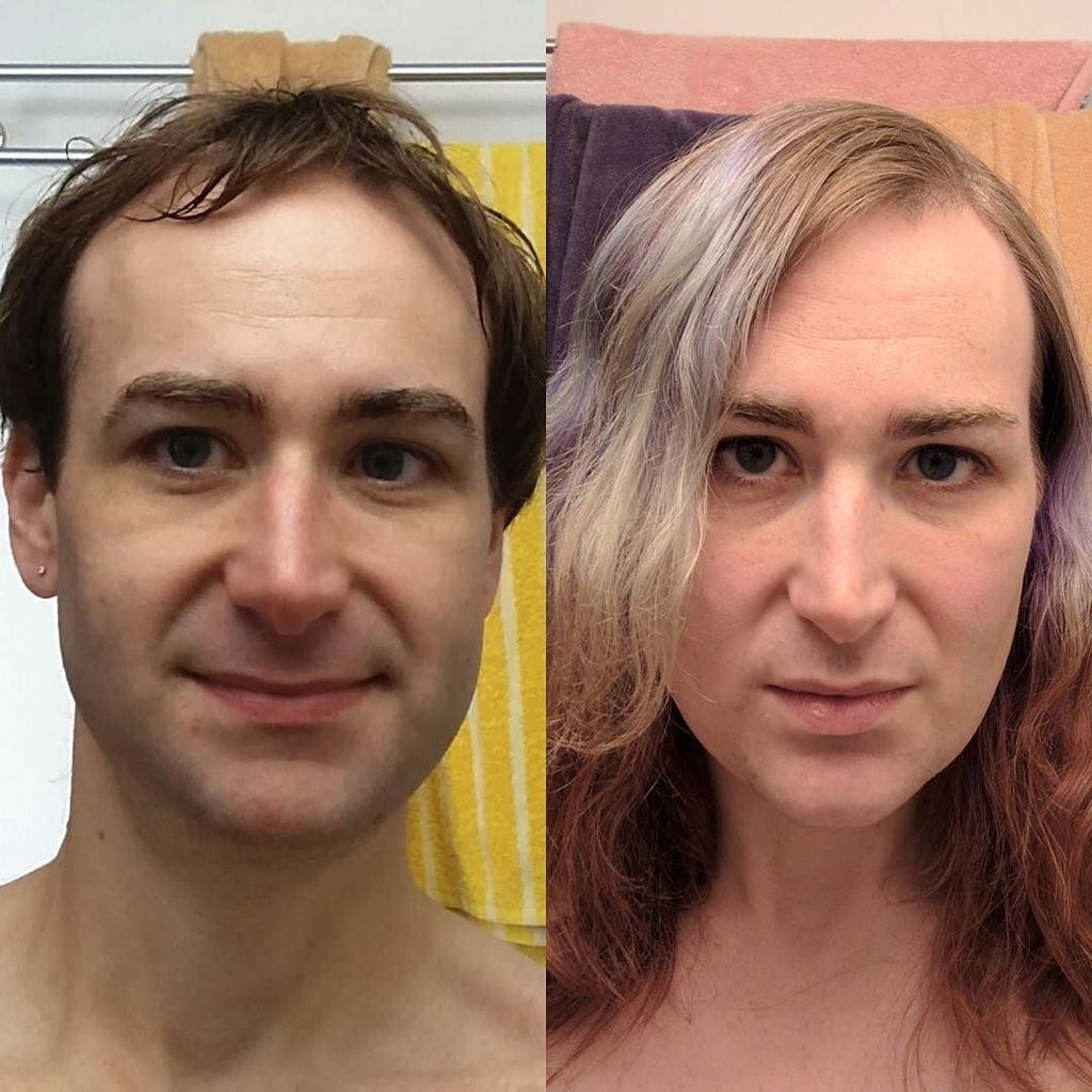 jamuraa's tweet photo. It's the 7th so it's time for one of these again. 23 months. #hrt #transitioning #transisb… https://t.co/jErSbSPp0g https://t.co/EHyu4rjtYS