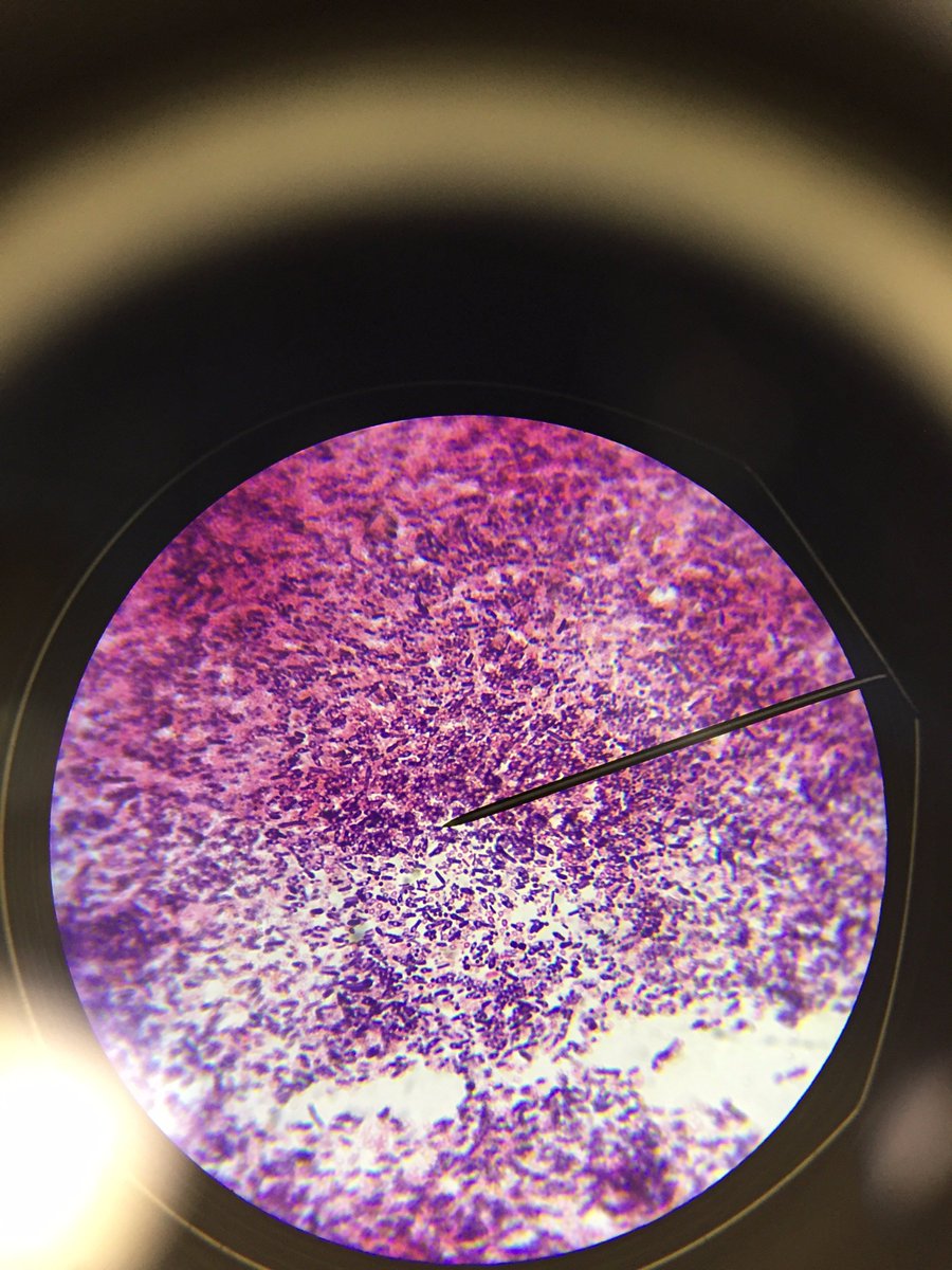 WillardScience's tweet photo. Advanced Biology Gram Staining to find gram positive bacillus with endospores #handsoninscience https://t.co/BBOn1YHdeq