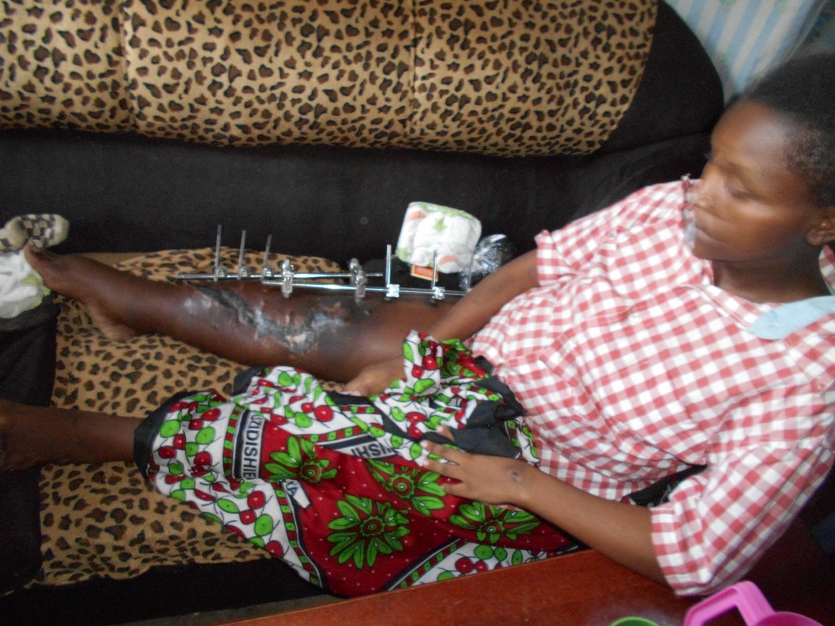 honleemuchiri's tweet photo. Spent #InternationalWomensDay taking to hospital an expectant lady who had an accident weeks ago but didnt have the means for full treatment https://t.co/vzttZell6s