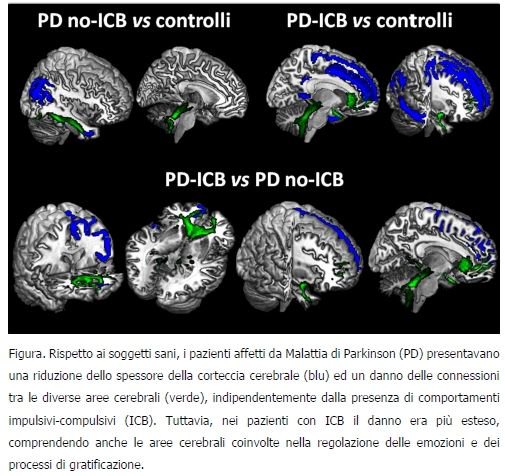 SanRaffaeleMI's tweet photo. Nuovo studio @SanRaffaeleMI: danni #cerebrali e comportamenti #impulsivi #compulsivi nel #Parkinson https://t.co/DDMUQpOTfC https://t.co/HjJdByTbOf