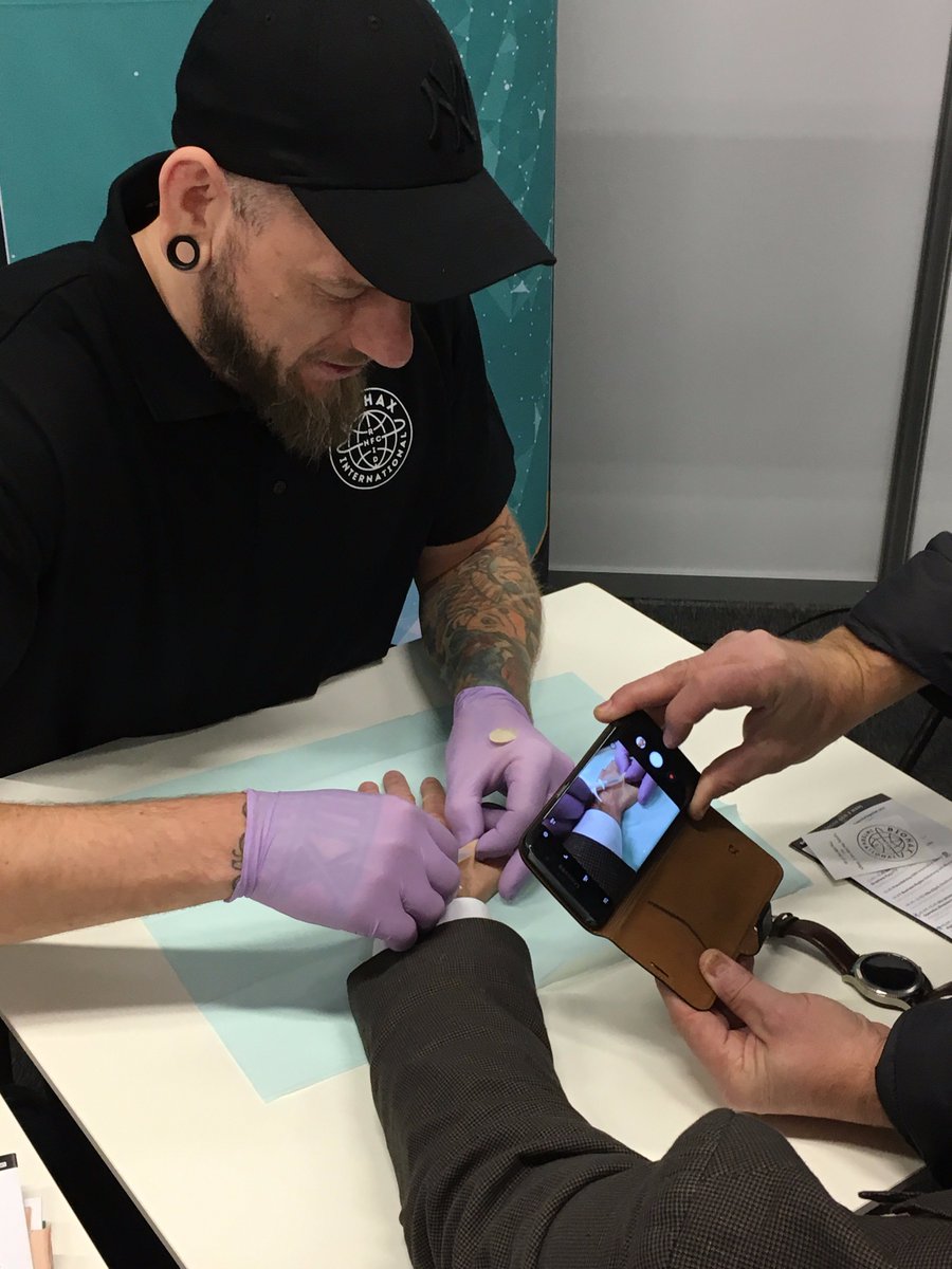 2017elektronik's tweet photo. Idag på mässan fick vi se när Jowan från Biohax chippade våra besökare på mässan, så spännande! Nu blir vi digitala! #elektronikgbg https://t.co/J0SvZCcuTo