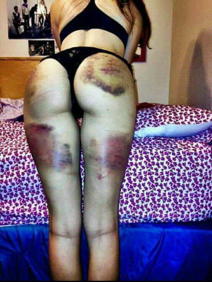sheila_lh's tweet photo. #DiaDelObjetoSexual me encanto como me dejaste <3 me dolió pero aprendí que hiciste esto por que me quieres uwu https://t.co/e2kbWvV7cU