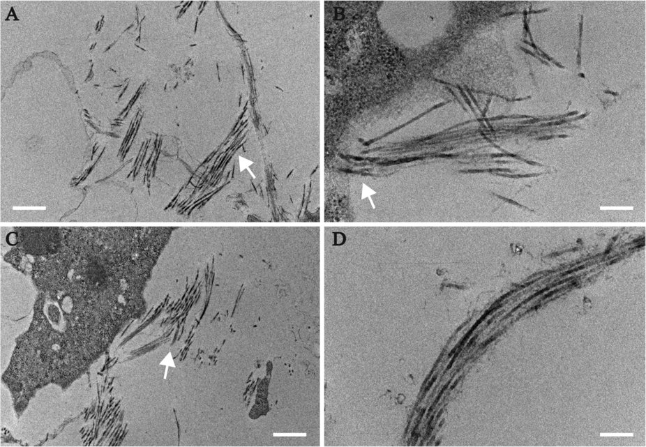 SciReports's tweet photo. #Cornea organoid cultures can benefit #cellmodelling of #diseases https://t.co/VFGGfthAj2 https://t.co/zBwv8pArlv