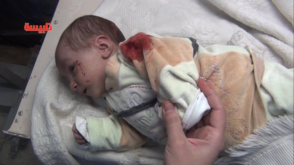 snhr's tweet photo. Image of a girl wounded in #SyrianRegime forces shelling on al Farhaniya al Sharqiya village in #Homs, Mar 9 https://t.co/FL8n6W9FIJ