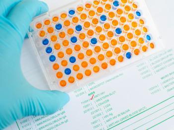Rx_Valet's tweet photo. Western blot and ELISA tests for HIV: What to expect https://t.co/S8G5zhGx1Z #prescription #LetsTalkRxvalet #Pharmacy #medicine #Rxcard https://t.co/tZRBCqficm