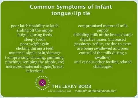 Intouchmomllc's tweet photo. @TheLeakyBoob Thank you for making such an informative infographic about tongue ties. https://t.co/CpmBsZJQrR
#InTouchMom #TheLeakyBoob https://t.co/owP7czmIV9