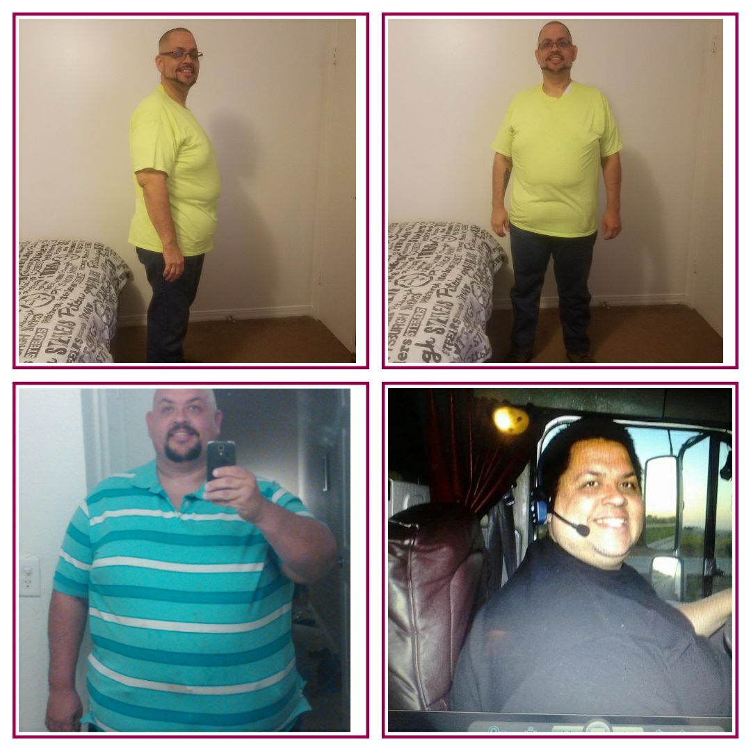 DrMBaptista's tweet photo. Our patient Adrian Pazo is living a healthier and happier life after his weight loss procedure! #beforeandafter #loseweight #weightloss https://t.co/ED3eXJ37He