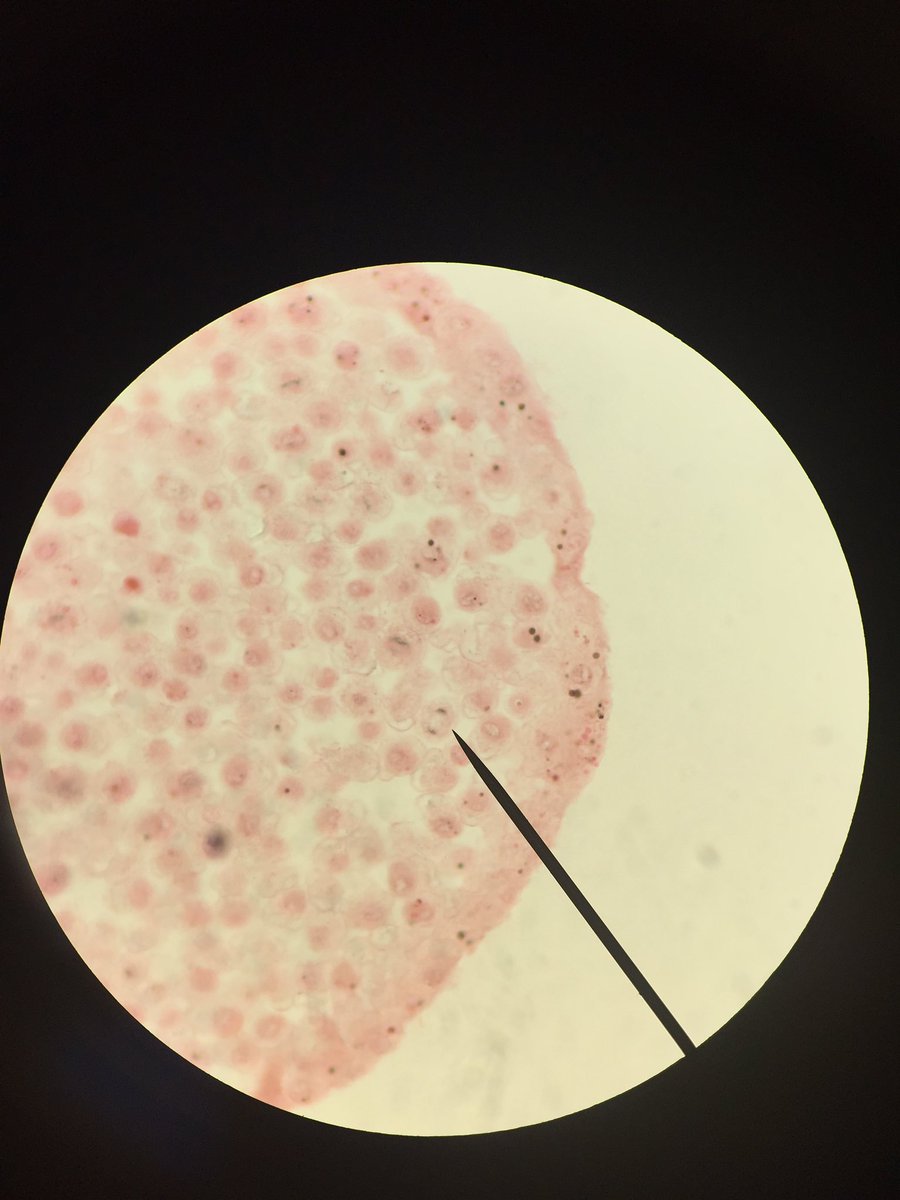ChillyDip15's tweet photo. Looking at a cell of a Whitefish in the Anaphase stage of Mitosis @UNKBiol106AC #CummingsLabWeek9 https://t.co/LcE0Q9Axv9
