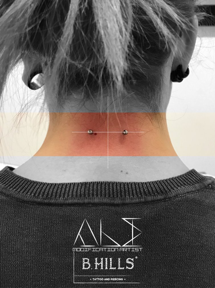bhillstattoo's tweet photo. •NAPE FRESH DONE•
Surface Realizzato da @AleBhills
#BhillsTattooCompany
#AleModificationArtist
#AleBodyPiercer
#Piercing
#Surface
#Nape https://t.co/Jpd4YHpJhX