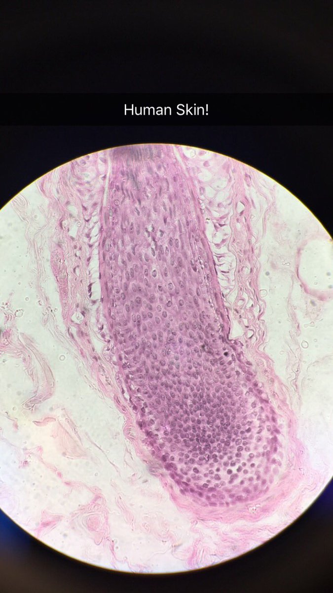 danidawn34's tweet photo. Mitosis in lab 🔬 @UNKBiol106AC #CummingsLabWeek9 https://t.co/gHiLcuY4ed