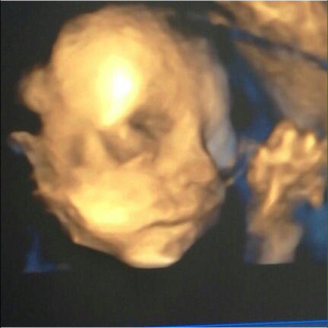 cacorrearamos's tweet photo. De las esperas mas felices que te da la vida, esperandote con ansias mi chiquito💙💙 #auntietobe #24weeksandcounting https://t.co/pqAbE5XPWa