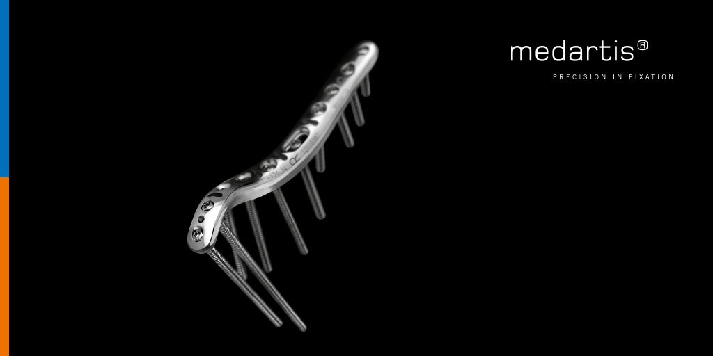 Medartis_Global's tweet photo. Innovative #APTUSElbow plates with #TriLock match complex anatomy of elbow https://t.co/ueFBwEvpMT https://t.co/Du7hnp3W4N