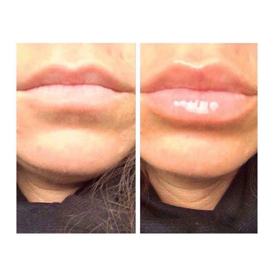 alison_acott's tweet photo. Who's ever wanted #LipFillers? 😗
Our #ContouringPlumpingLipgloss stimulates &amp; promotes collagen growth! 
#NoPain #NoTingle
DM FOR INFO! 💌 https://t.co/lKG1Aletfr
