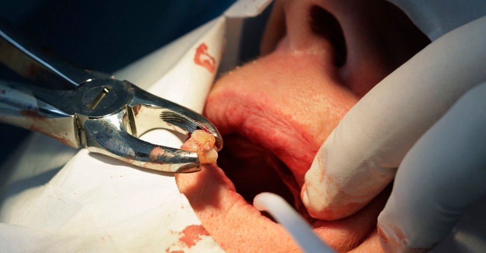 AllScan3D's tweet image. Why is Dentistry Separate From Medicine?

buff.ly/2m9lIR5