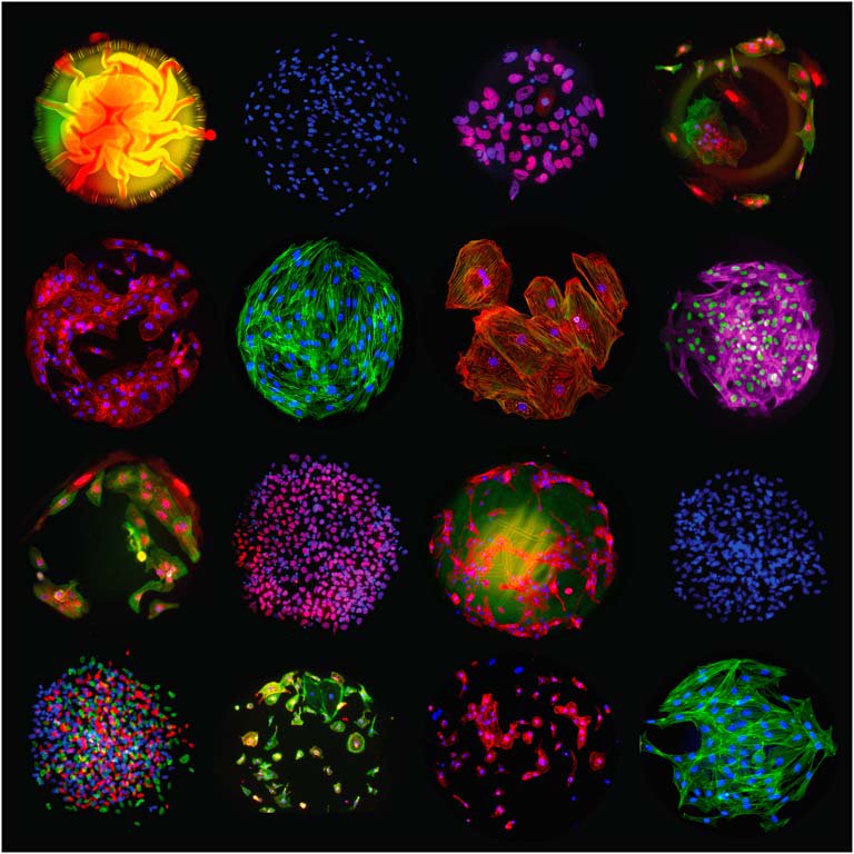 Koch Institute at MIT (@kochinstitute) on Twitter photo Not going to drop in to say bye to this award-winning 2016 image by <a href="/AshaKPatel/">Asha K Patel</a>? Ah well, suit your cell… #KIImages bit.ly/2h9Qd75 Not going to drop in to say bye to this award-winning 2016 image by <a href="/AshaKPatel/">Asha K Patel</a>? Ah well, suit your cell… #KIImages bit.ly/2h9Qd75