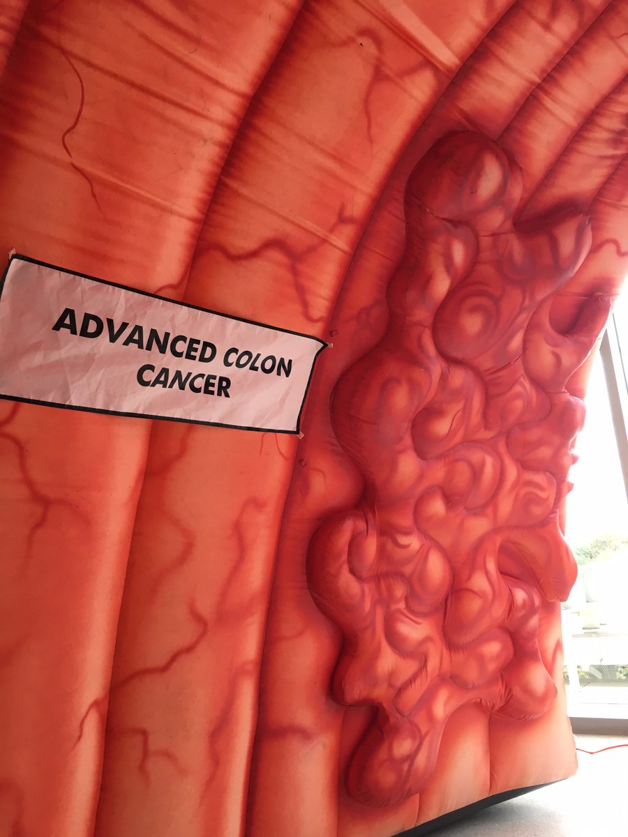 SnehaMPH's tweet photo. In case you haven't noticed, we're pretty excited about this GIANT colon!! #ColonCancer #CancerCHE #ColorectalCancerAwarenessMonth https://t.co/pSB8DYVI1E