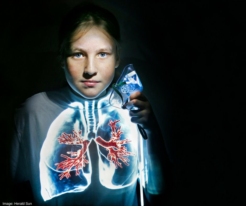 GoodFriAppeal's tweet image. Thanks to our fundraisers, RCH clinicians can provide better services for sick children through new imaging services ow.ly/jXYB309LzOU