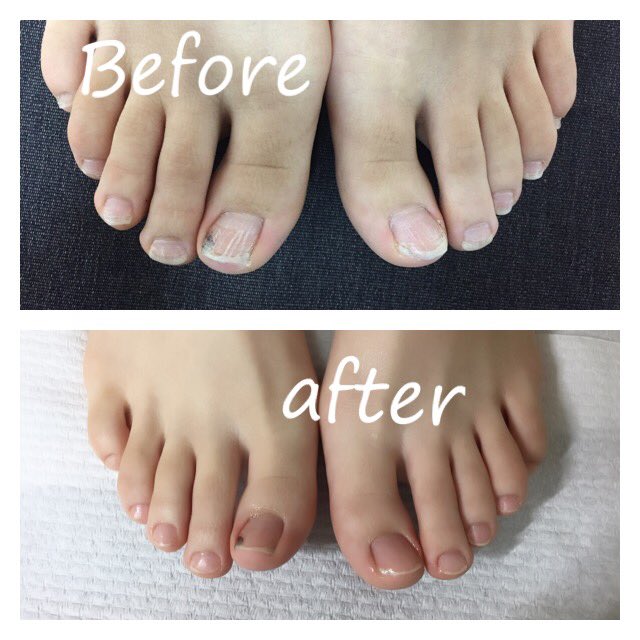 ネイルサロンアヴァンス 中野新橋 Nailsalonavance Twitter