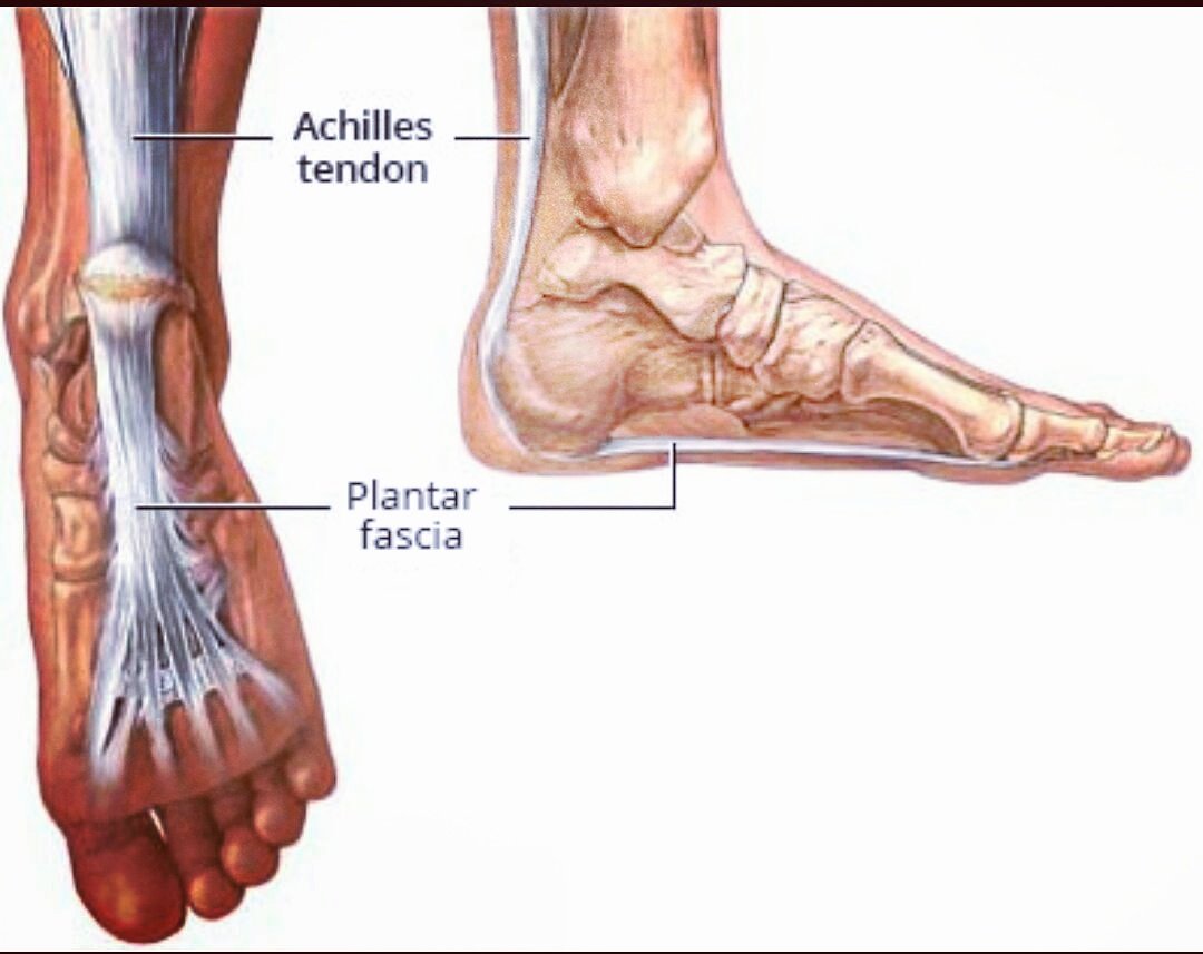lasercare_'s tweet photo. #PlantarFasciitis #LaserCare #BioFlexLaser #painful #PainReliefTherapy Call 0858667415 https://t.co/lbqlozS0fD https://t.co/sathqXQvHk
