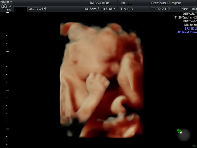 GlimpsePrecious's tweet photo. 👶Available Appointments Next Week! 👶 
Thursday 16th March 10am, 12pm,
Friday 17th March 11am,12pm,
Saturday 18th March 9am, 1.30pm. https://t.co/66W3qLJDHi