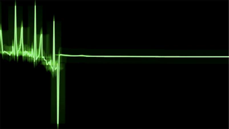 DeliciaWitherow's tweet image. Brain activity recorded as much as 10 minutes after death

bit.ly/2mdHyE8