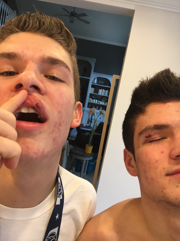mike_ved's tweet photo. What's Take to Get a State Title?  Grit And Glue And Stitches!😂😂😂 #NoBloodNoFoul https://t.co/uahqH325D1