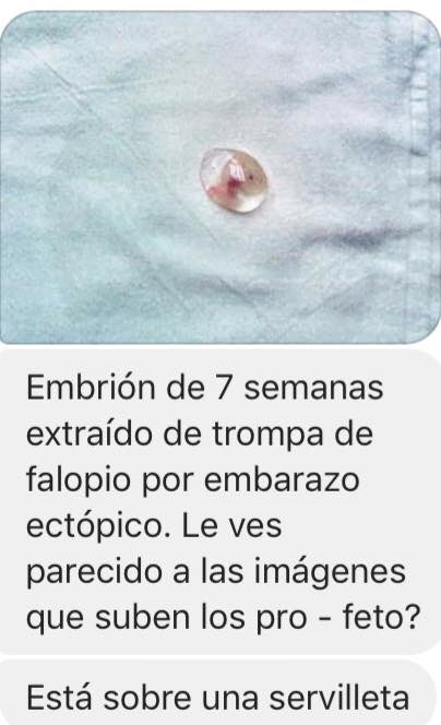 Rorroou's tweet image. #Profeto