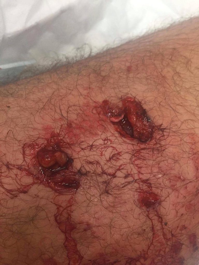 Artık konuşmayı bırakalım. Sözün bittiği yerdeyiz. Bu itlere anladığı dilden cevap veremezsek yazıklar olsun!