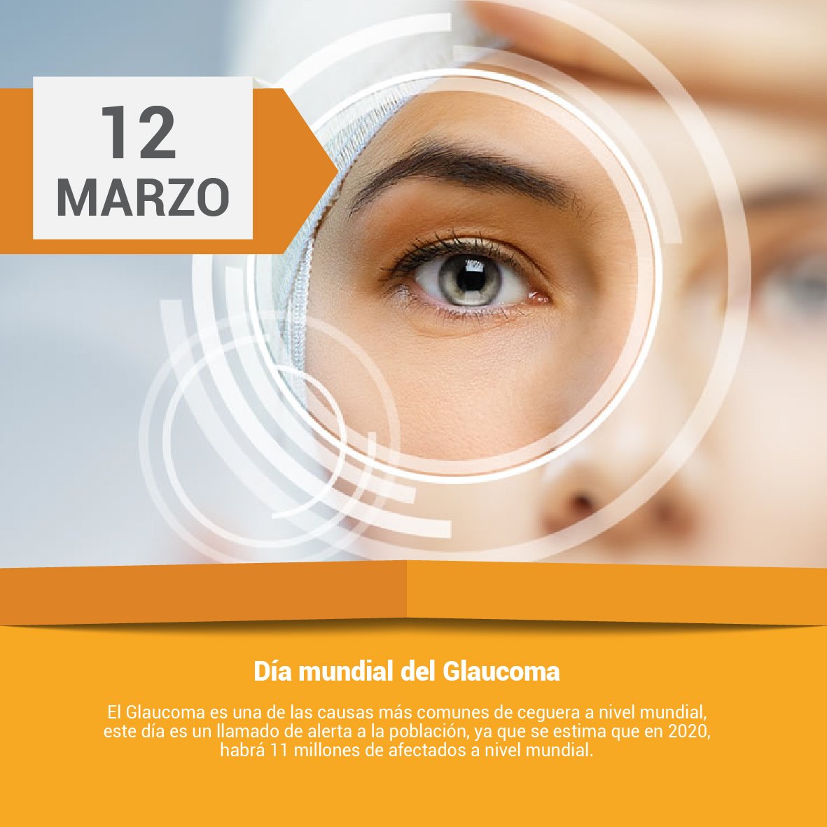 Hoy se conmemora el Día Mundial del Glaucoma.