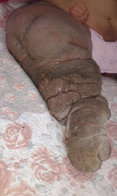 عرض الصورة على تويتر عرض الصورة على تويتر