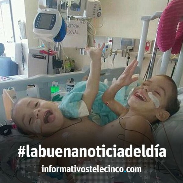 #Labuenanoticiadeldía El dulce cumpleaños de unas pequeñas siamesas tras la arriesgada separación > bit.ly/2mPOURn