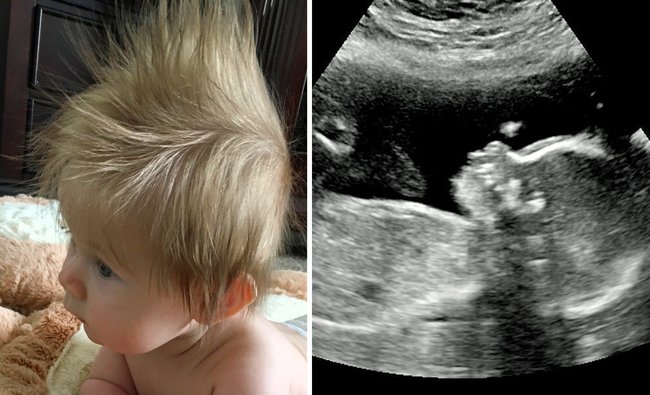 赤ちゃん 髪の毛 多い 692124赤ちゃん 髪の毛 多い カット Imagejoshwgu