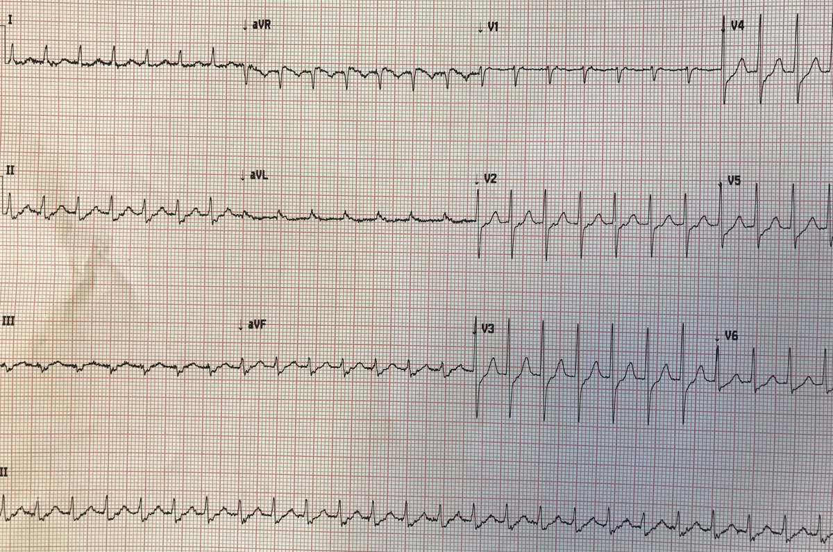 atypicalflutter's tweet image. What is your opinion?