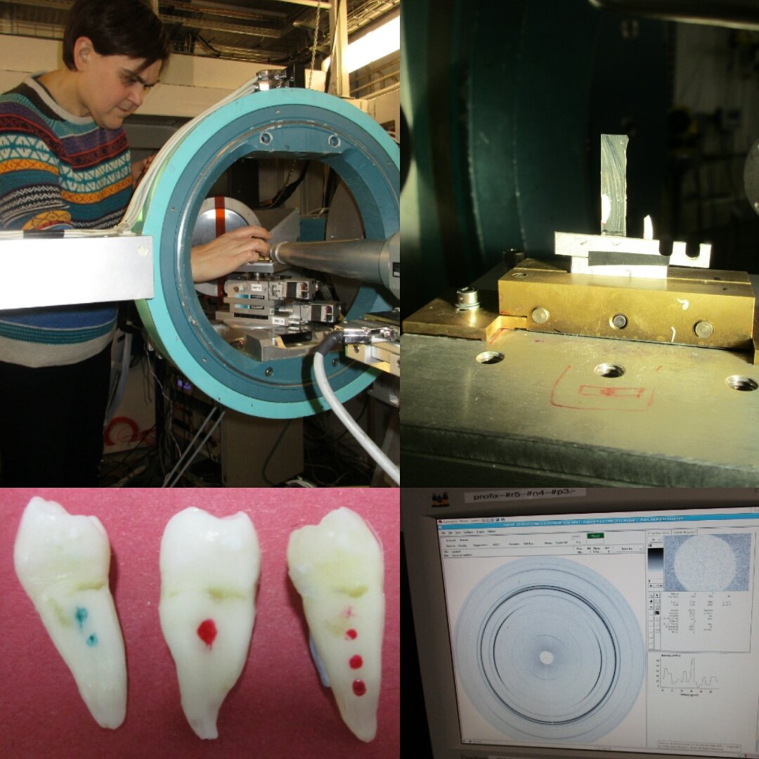 Maisoon Al-Jawad (@profmaisoon) on Twitter photo On <a href="/XMaSBeam/">XMaS Beamline</a> <a href="/esrfsynchrotron/">European Synchrotron</a> this week doing 2DXRD on teeth to find out why saliva is so important in protecting our tooth enamel. On <a href="/XMaSBeam/">XMaS Beamline</a> <a href="/esrfsynchrotron/">European Synchrotron</a> this week doing 2DXRD on teeth to find out why saliva is so important in protecting our tooth enamel.