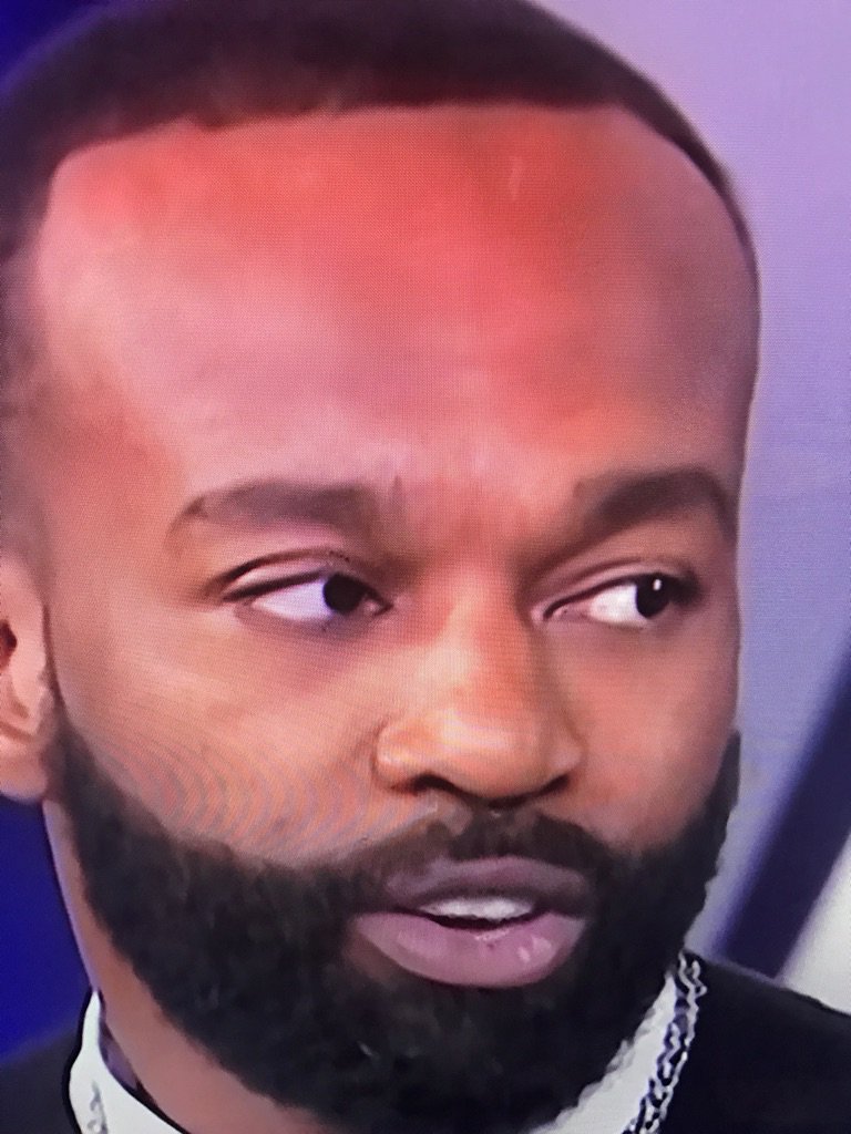 violajefe's tweet photo. My Brodie @BaronDavis forehead Huuuuuuge! #thatsmyninjadoe https://t.co/ZiUINMecTA