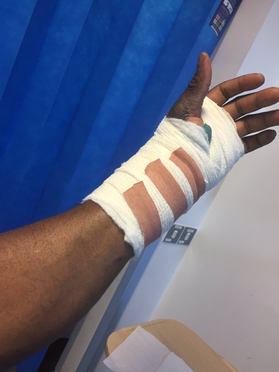 wegbe4's tweet image. Lister hospital well done #Carpel Tunnel operation