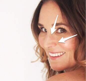 RedcliffeStyle's tweet image. Beauty: Laser Vein Removal Treatment redcliffestyle.com/beauty-laser-v…