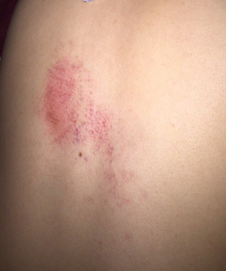_kingbarbie's tweet photo. @ani_b0530 #aftermath for everyone to see 😂 https://t.co/fzcw7mzhbT