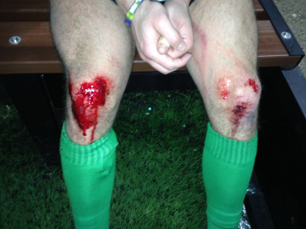 MartynThomas15's tweet photo. Gutted for everyone involved at @RFCMerthyr.Great occasion but a tough loss.I do ask @PontypriddRFC to sort their 4g pitch out though please https://t.co/TyeqnAjUuT